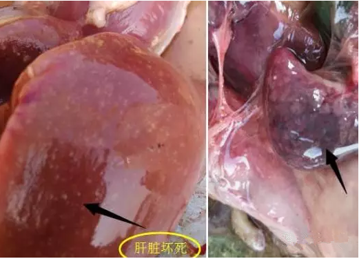 鹅肝脏肿大_副本